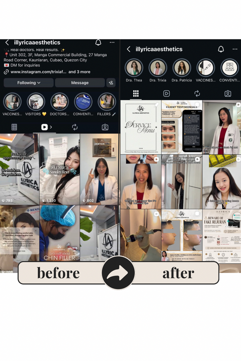 Illyrica Aesthetics Before and After